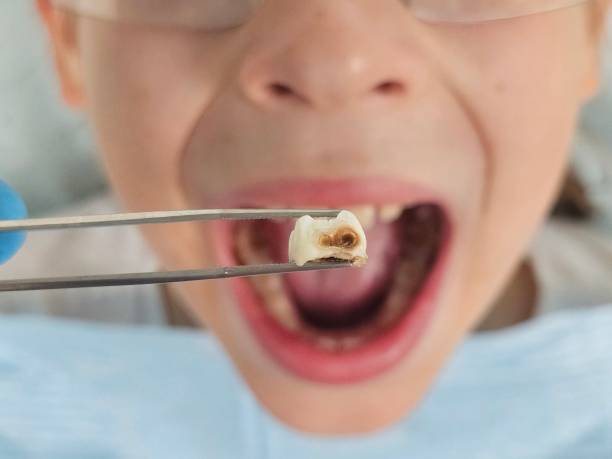 Best Emergency TMJ Treatment in Lyles, TN